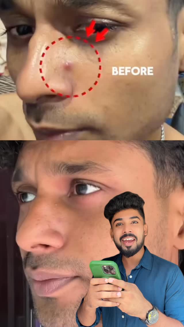 Nandu